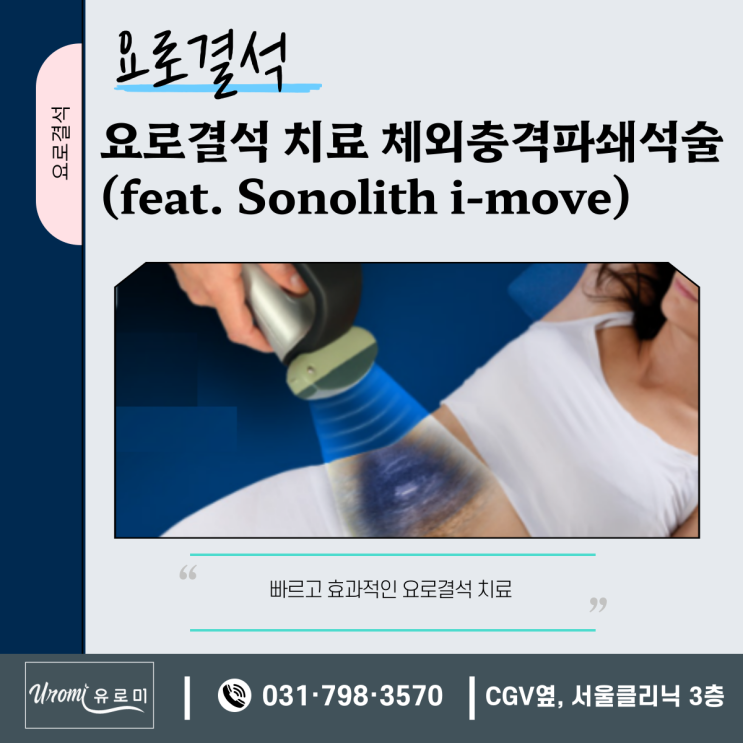  [요로결석]광주비뇨기과에서 알려드리는  최첨단 I-move 쇄석기