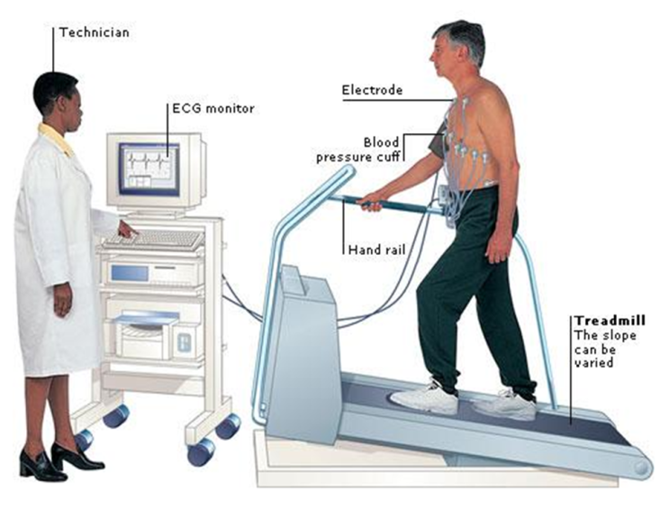  운동부하검사 방법, 주의사항(TMT, treadmill test)