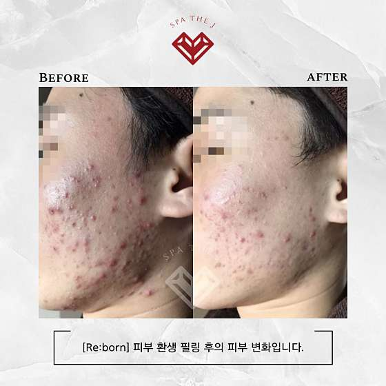 스파더제이 사진 3