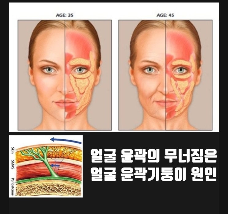 얼굴 윤곽의 생명나무, 안면유지인대 제대로 알기