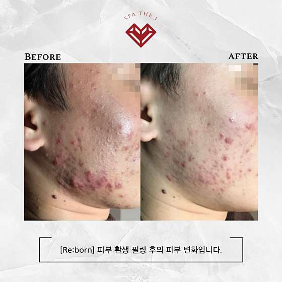 스파더제이 사진 2