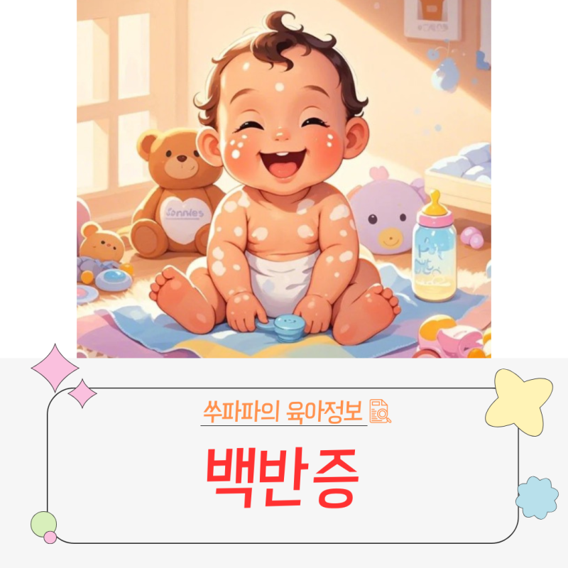 아기 피부 백반증, 걱정 말고 이렇게 관리해보시져!!!
