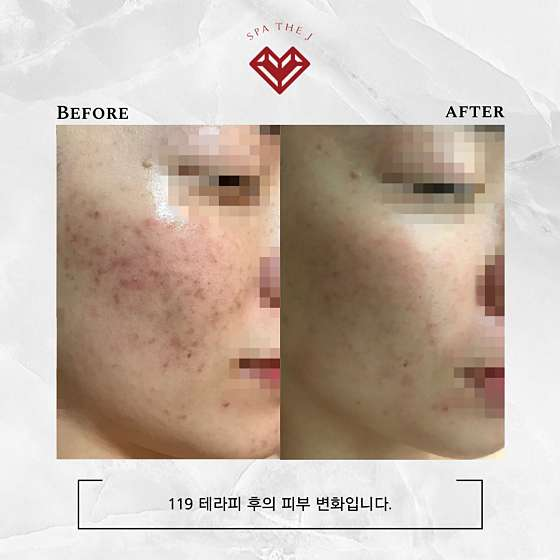 스파더제이 사진 4