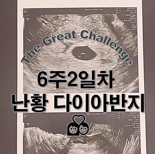  임신6주 초음파 난황 다이아몬드 임신초기증상과 파이널임테기