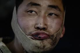 젤렌스키 "<b>북한군</b> 2명 <b>생포</b>해 심문 중"… 붕대 감고 구금된... 
