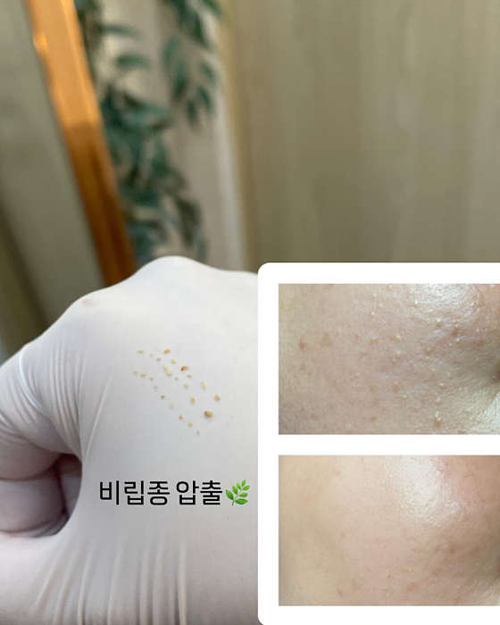 라벨르에스테틱 사진 6