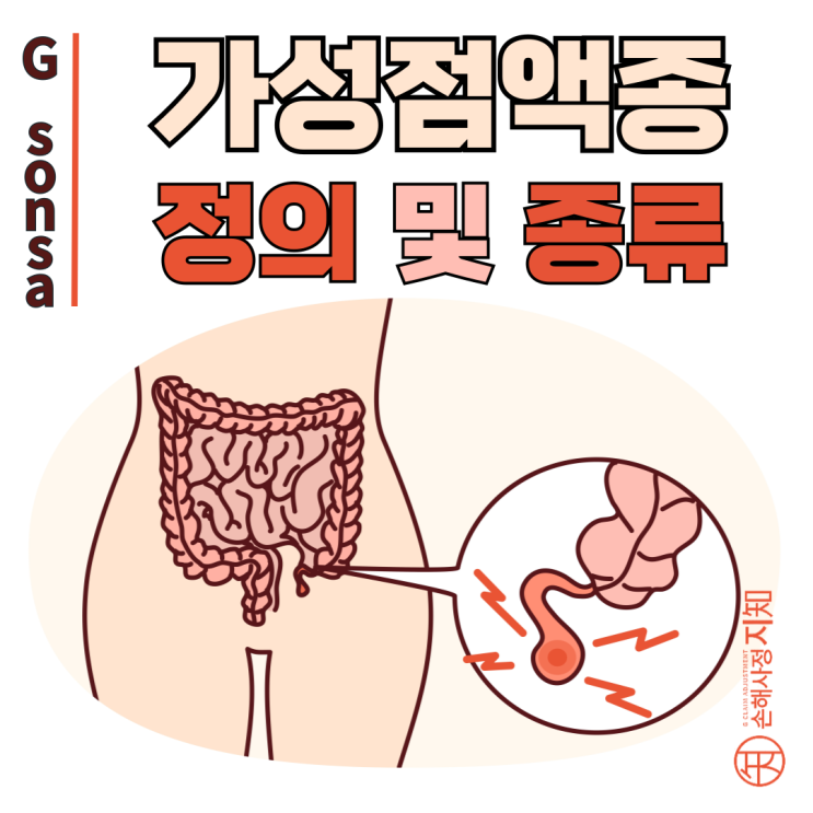  가성 점액종(PMP), 복강에 쌓인 점액의 정체는? - [암, 1부]