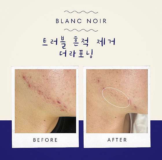 브랑누아뷰티 사진 1
