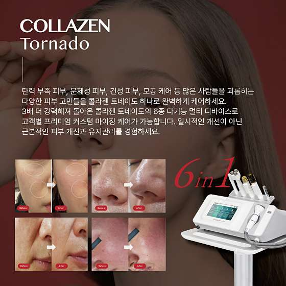 더스킨 사진 6