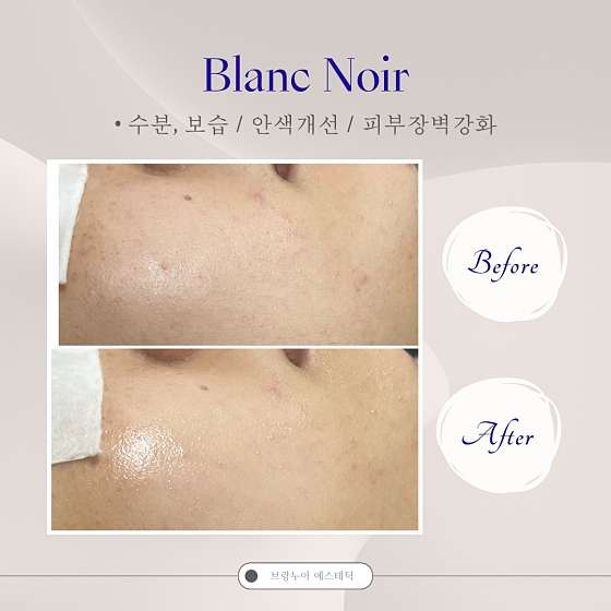 브랑누아뷰티 사진 6