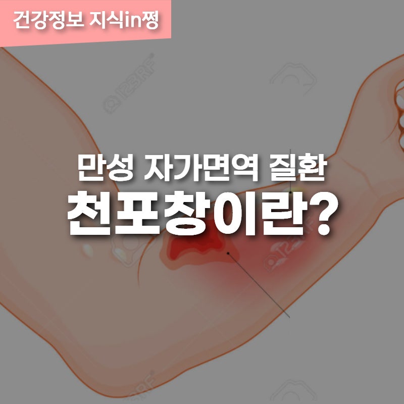 자가면역질환 천포창 증상과 만성되지 않기 위한 관리방법