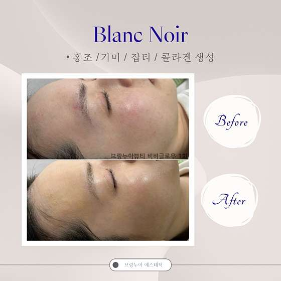 브랑누아뷰티 사진 3