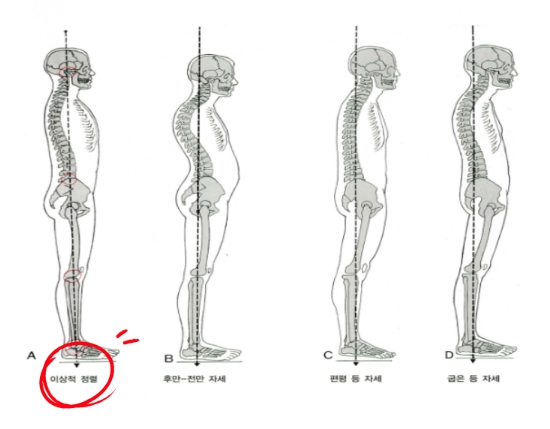  앉아있을때 허리통증? 척추운동으로 해결 한 case