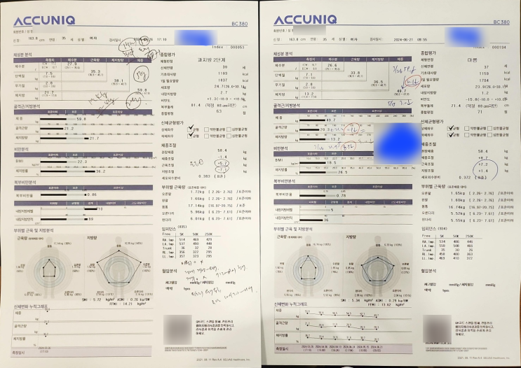  [치료 사례]직장맘, 8년 만에 출산 전 몸무게로 리턴! 2개월 10kg 감량