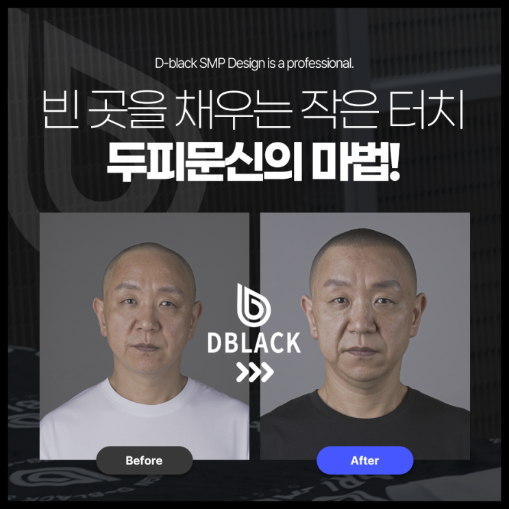 빈 곳을 채우는 작은 터치, 두피플랜팅의 마법!