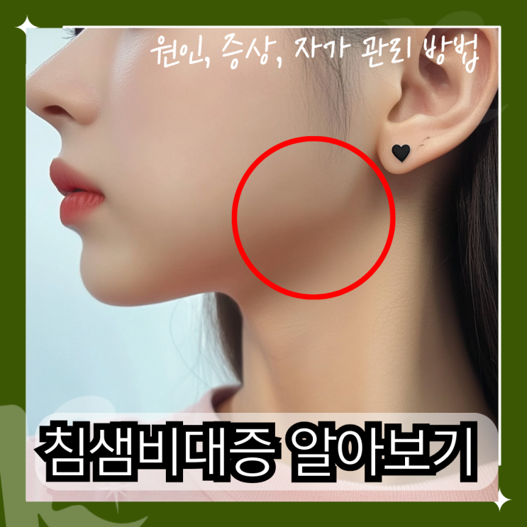  침샘비대증 원인, 증상, 자가 관리 방법까지 알아보는 가이드