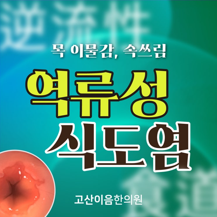  의정부 용현동한의원, 겨울에 주의해야 할 역류성 식도염