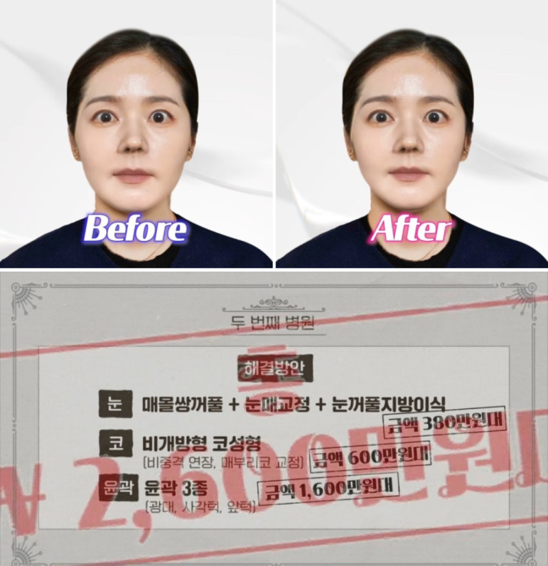 42세 한가인, 3000만원대 성형 견적 ( 자유부인 한가인)