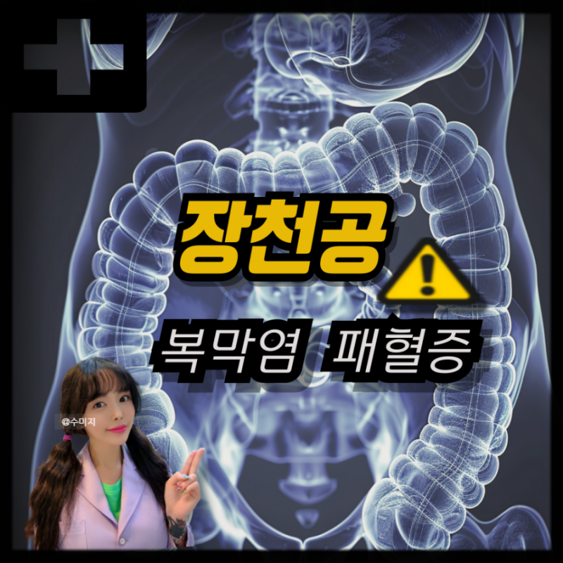 장천공 원인 증상 복막염 증상 패혈증