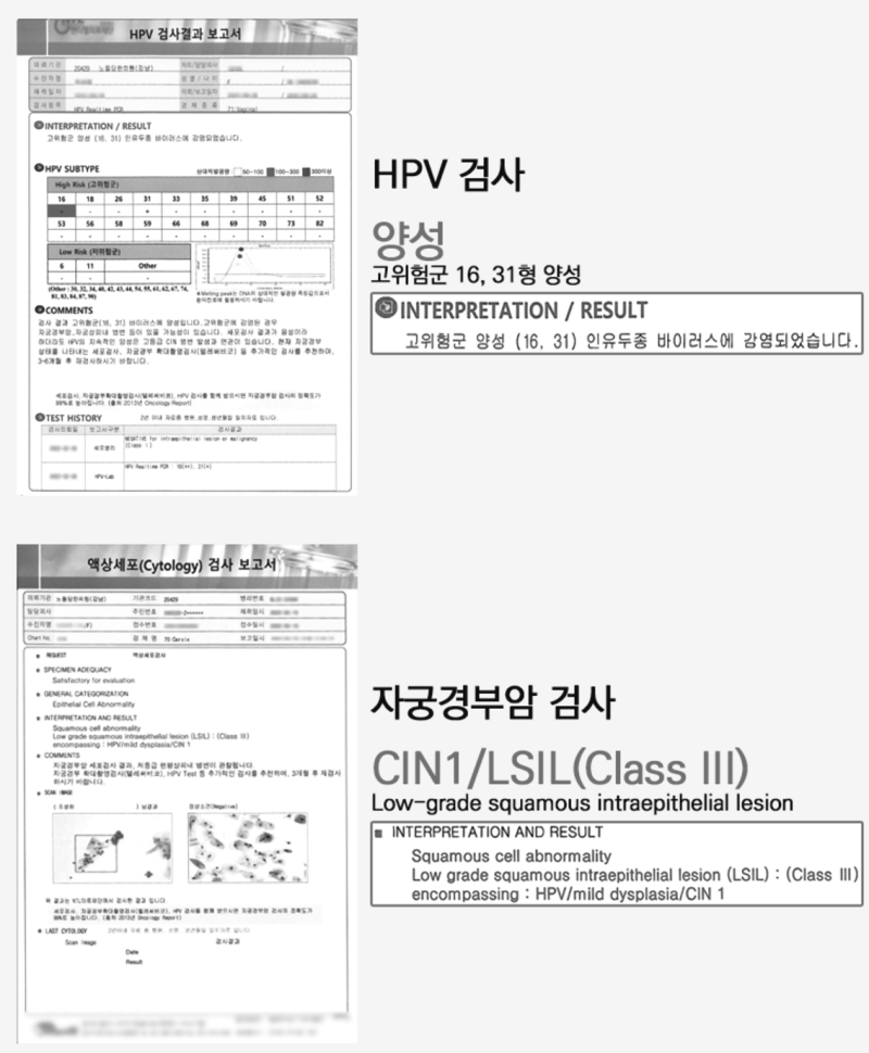 자궁경부암 전단계 이형성증의 사망률 제대로 알아봅시다!