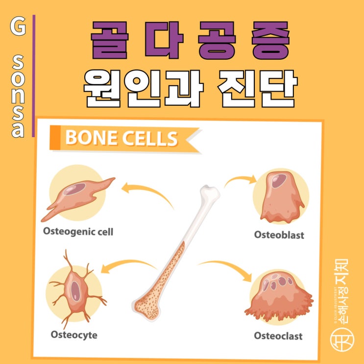  골다공증 원인, 진단 그리고 보험 - 무엇이 분쟁의 원인일까? - 엄마의 질병, 1부]