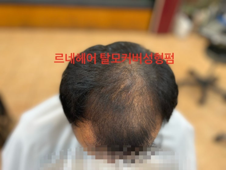  부산남자탈모결혼식준비 탈모헤어결혼준비끝사상구르네시떼미용실/ 부산경남남해경북울산김해전남전북충남충북강원경기서울