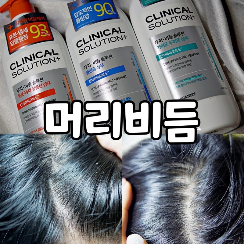 머리비듬 두피비듬 비듬생기는이유 비듬케어샴푸 엘라스틴 오가니스트샴푸