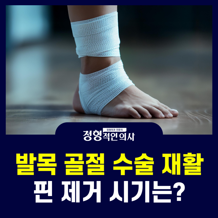  발목 골절 수술 치료, 재활치료, 핀 제거 시기는? (의사 작성)