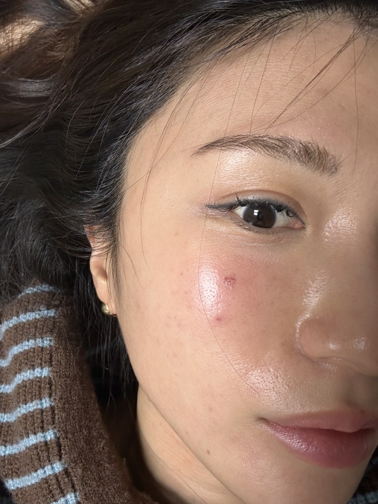  인천 검단 미백관리 기미제거 잘하는 곳 미작뷰티 추천