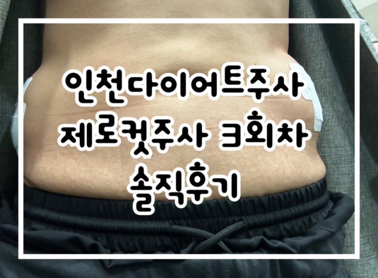  인천다이어트주사 제로컷주사 남자 옆구리 3회차 솔직후기