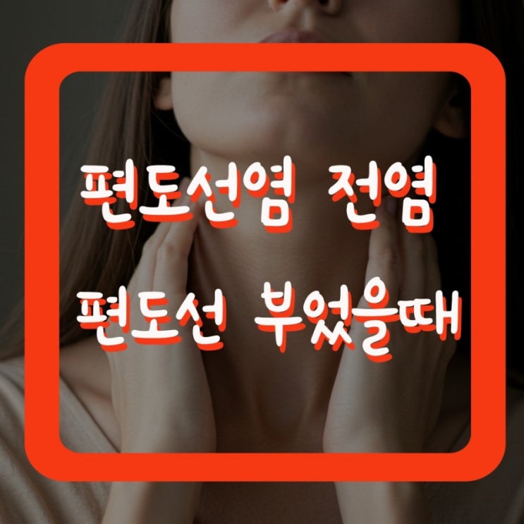  편도선염 전염 편도선 부었을 때 그냥 둬도 될까?