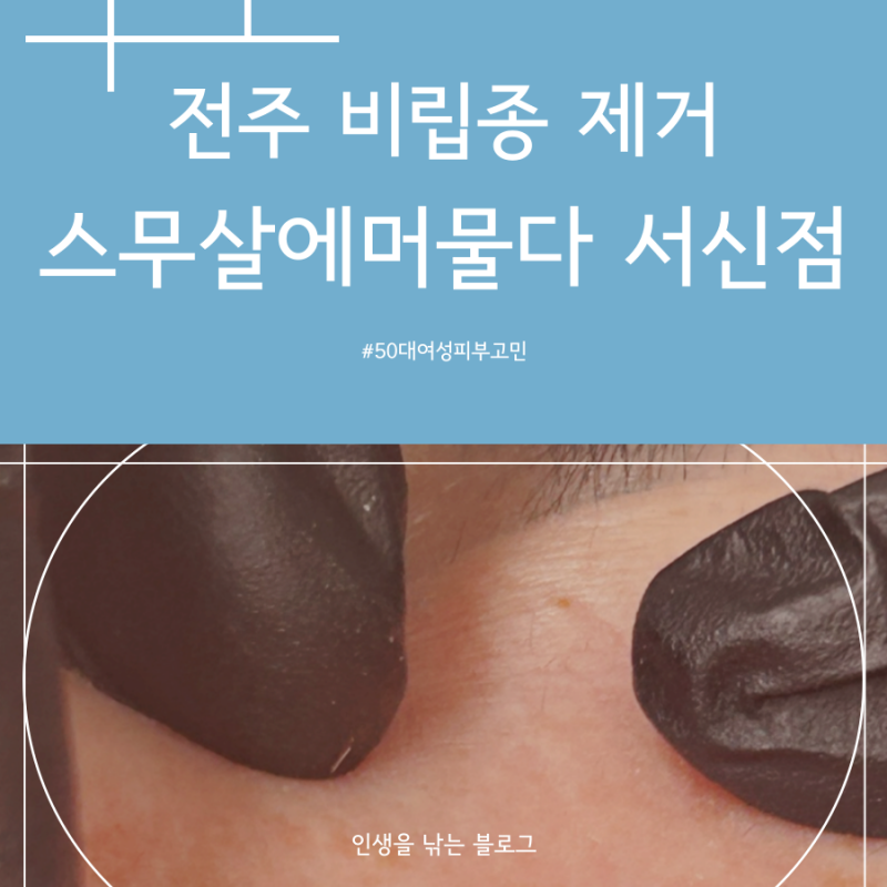 [전주 완산구] 전주 비립종 제거 스무살에 머물다 서신점에서 50대 여성 피부고민 해결하기