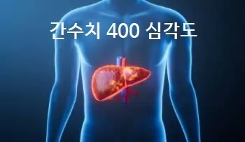  간수치 400 심각도