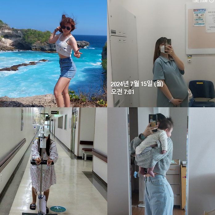  임신 출산 후 뱃살, 진짜 안 빠질까? 제왕절개 후 6개월 간 몸매 변천사