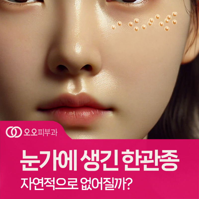 대구현풍 한관종이란? 원인부터 치료법, 관리까지 총정리