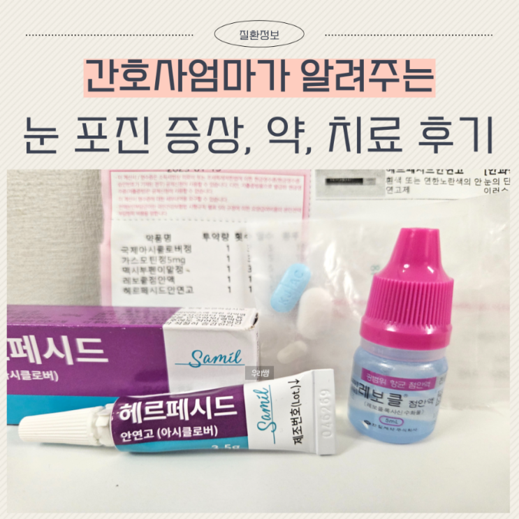  눈 헤르페스 증상 전염 연고