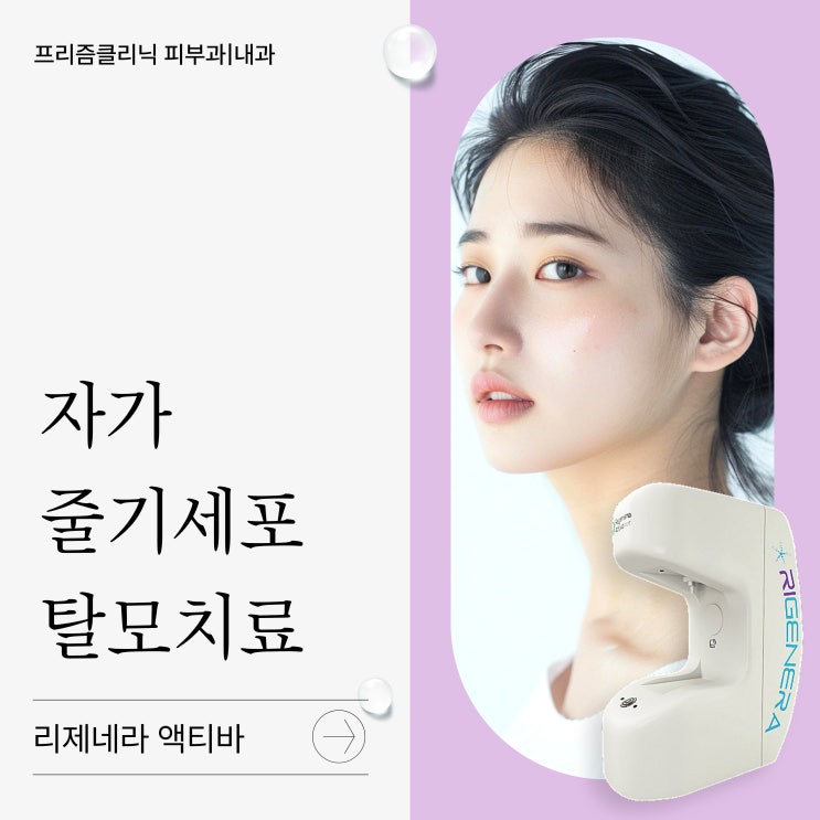  연희동피부과 단 한번의 시술로 피부와 탈모 동시에 개선, 자가줄기세포 치료법