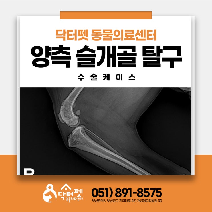  8살 강아지 양측 슬개골 탈구 수술 뛰어내림 다리 절음 부산 정형외과 동물병원