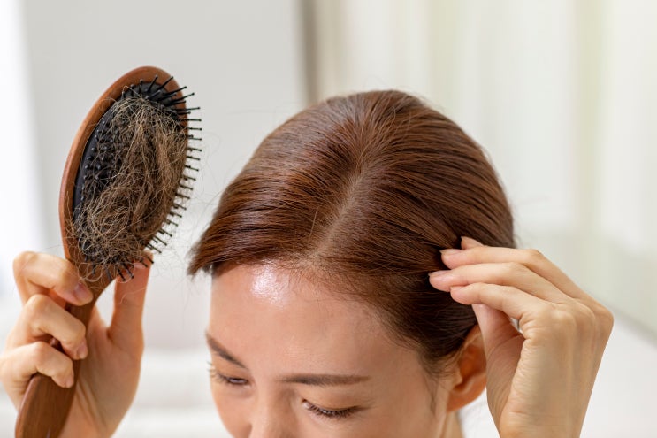  동탄헤어가 알려주는 두피염 관리, 건강한 두피로 되돌아가는 올바른 방법