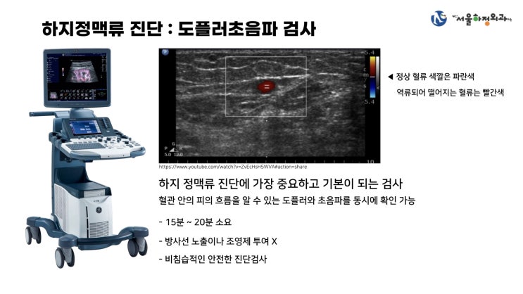  하지정맥류 검사방법 자가진단부터 초음파까지