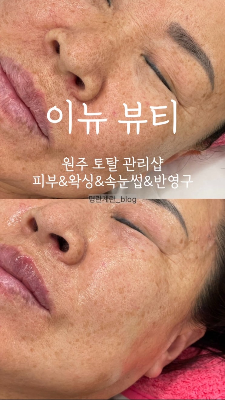  이뉴뷰티 :: 원주에서 피부 광채 및 탄력, 미백 관리는 이뉴뷰티에서 전부 다 해결 가능