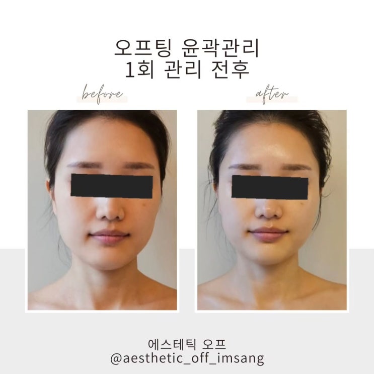  광주윤곽관리 | 결혼식 전 신부가 꼭 알아야 할 샵 선택 기준 3가지