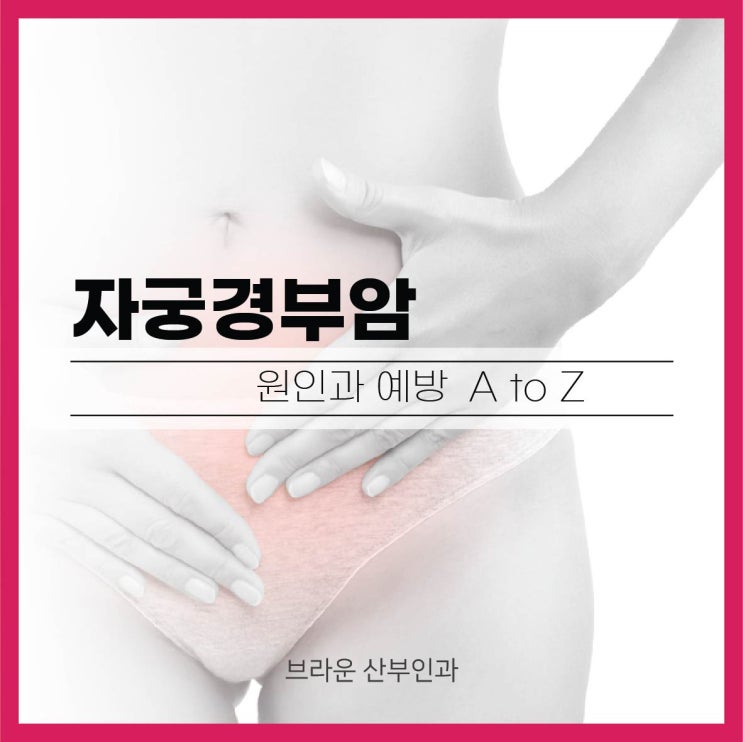  을지로입구산부인과 자궁경부암 원인과 예방