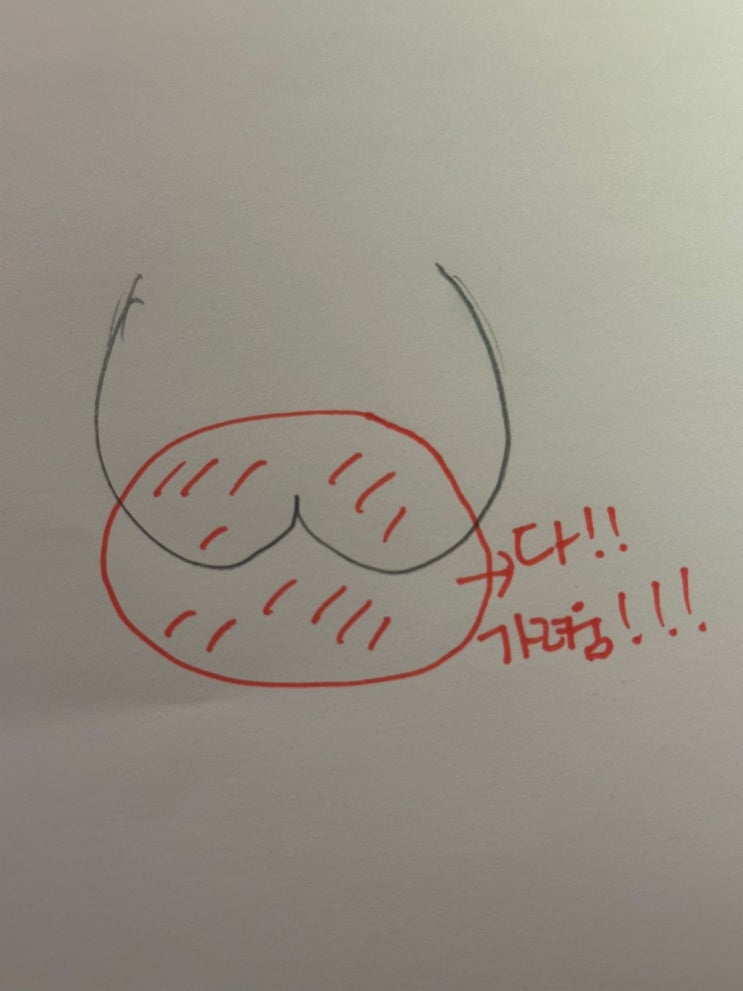 항문 가려움 비판텐 약국 효과 후기