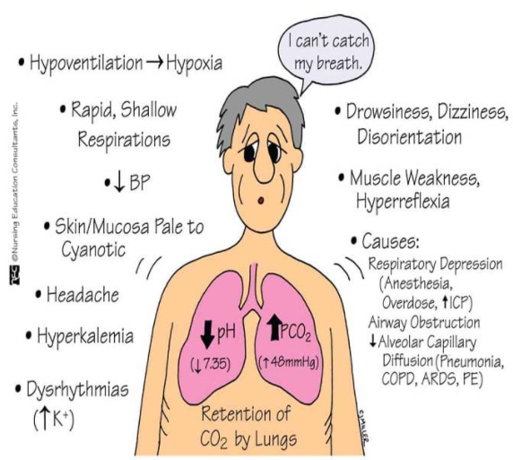 호흡기 산증의 원인과 증상을 치료하는 방법 1