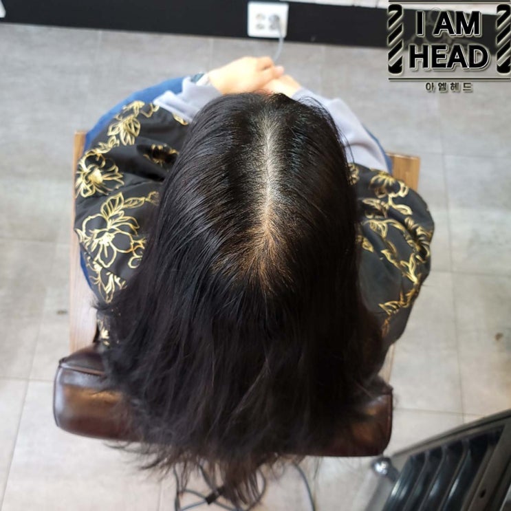  모류교정 링거펌으로 두상성형하기! [수원미용실 아엠헤드]