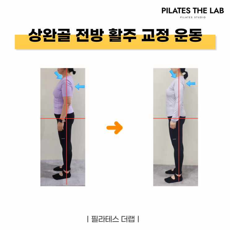  목동 필라테스 상완골 전방 활주 교정 운동