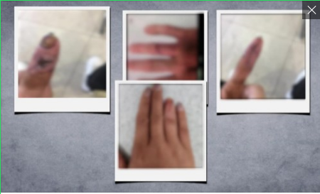 산재보험금 타려고 자해...불법체류자·브로커 적발 산재보험금 타려고 자해...불법체류자·브로커 적발