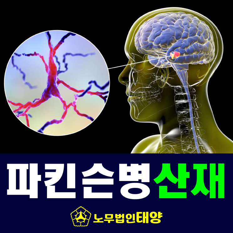 [신경계질환] 파킨슨병 산재 신청 처리방법