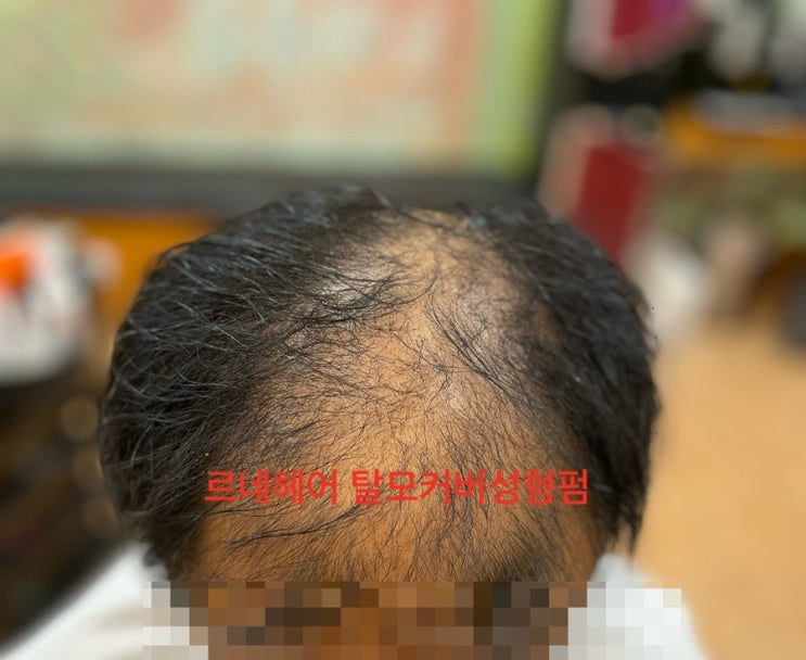  이곳저곳탈모펌대실망 탈모성지르네시떼미용실을 알고나서야 환골탈퇴남자는머릿빨이야! / 괘법주례감전사상당감개금전포양정연제동래명륜온천사직수영해운대망미광안남펀용호센텀가야남포초량감천영도